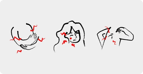 Three line drawings of PCOS symptoms